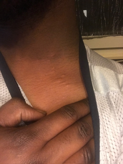 Japhet - Schlossrued - Argovie | Annonce Rencontre